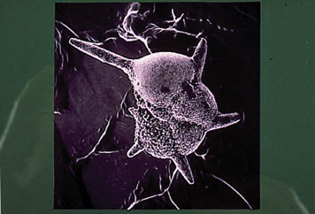 Photograph of Hantkenina alabamensis microfossil
